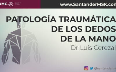 9# Patología traumática de los dedos de la mano