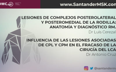 Lesiones de CPL y CPM de la rodilla: Anatomía y diagnóstico RM + Influencia de las lesiones asociadas de CPL y CPM en el fracaso de la cirugía del LCA