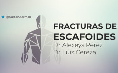 #5 Fracturas de escafoides